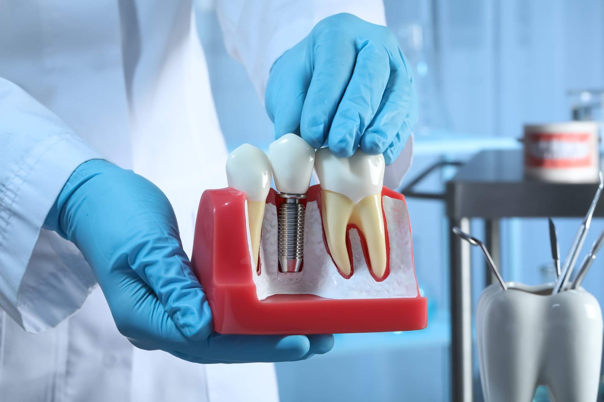 Un dentista sostiene un modelo de un diente con un implante en él.