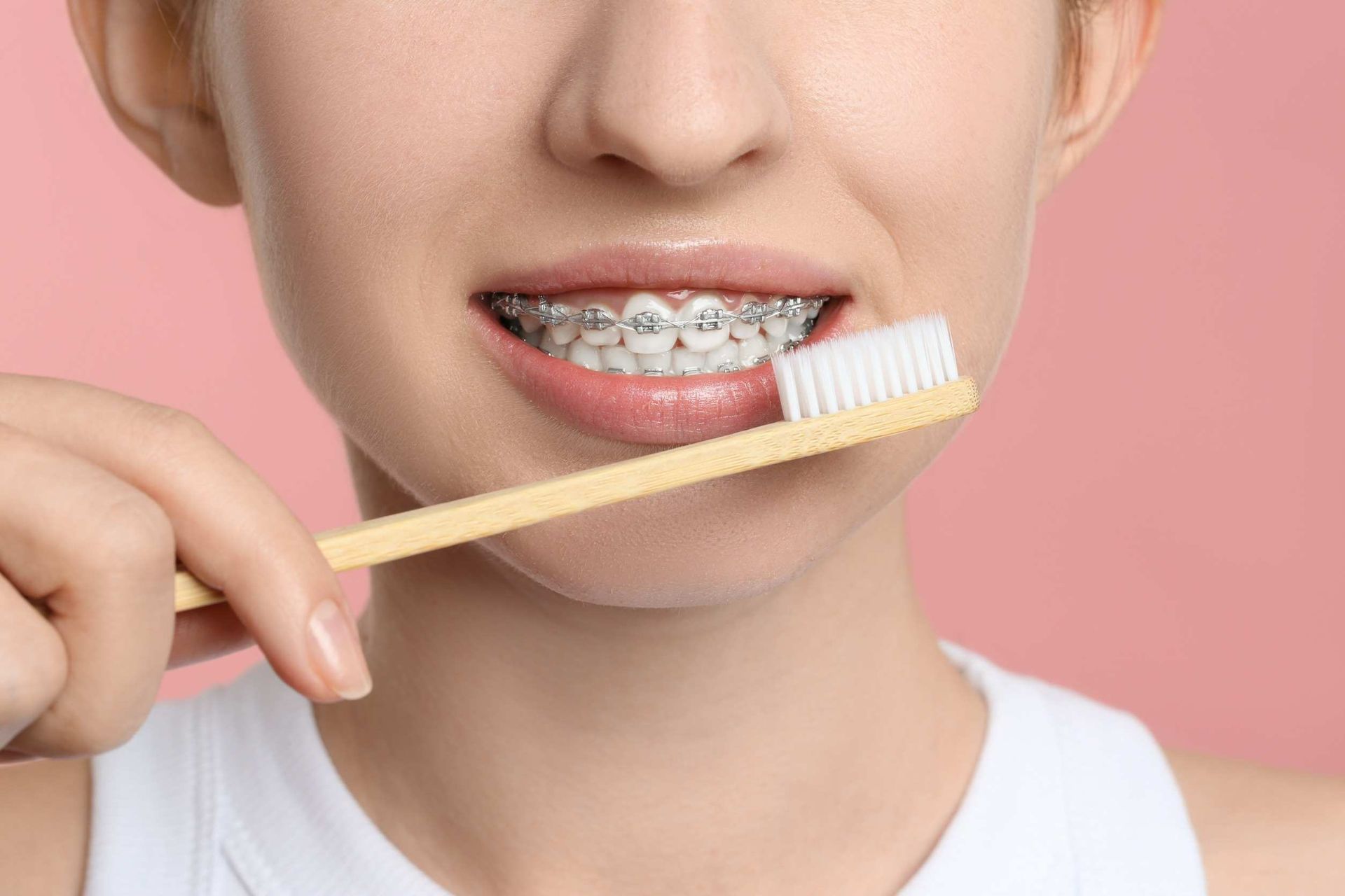 Una mujer con aparatos dentales se cepilla los dientes con un cepillo de dientes.