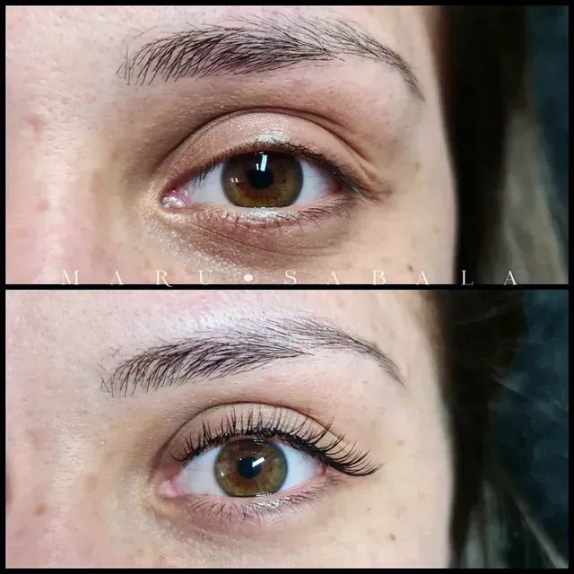 Una foto de antes y después del ojo de una mujer.