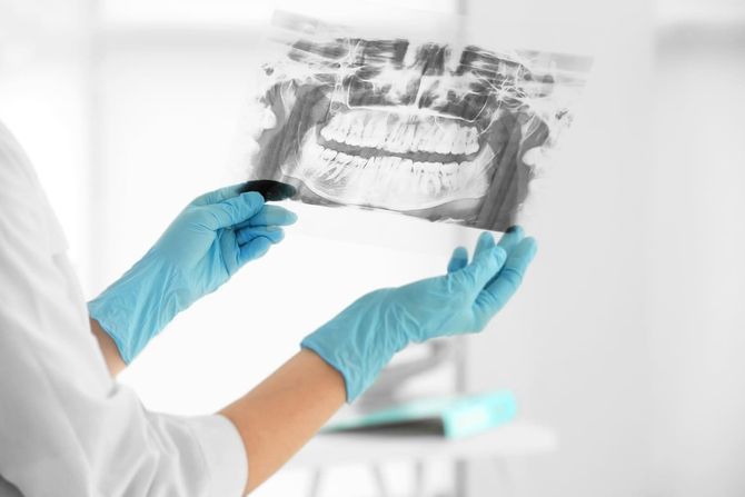 Un dentista sostiene una radiografía de los dientes de una persona.
