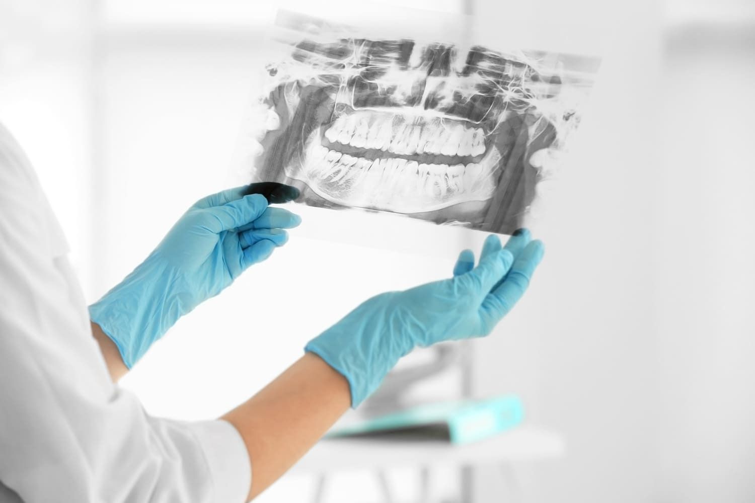 Un dentista sostiene una radiografía de los dientes de una persona.