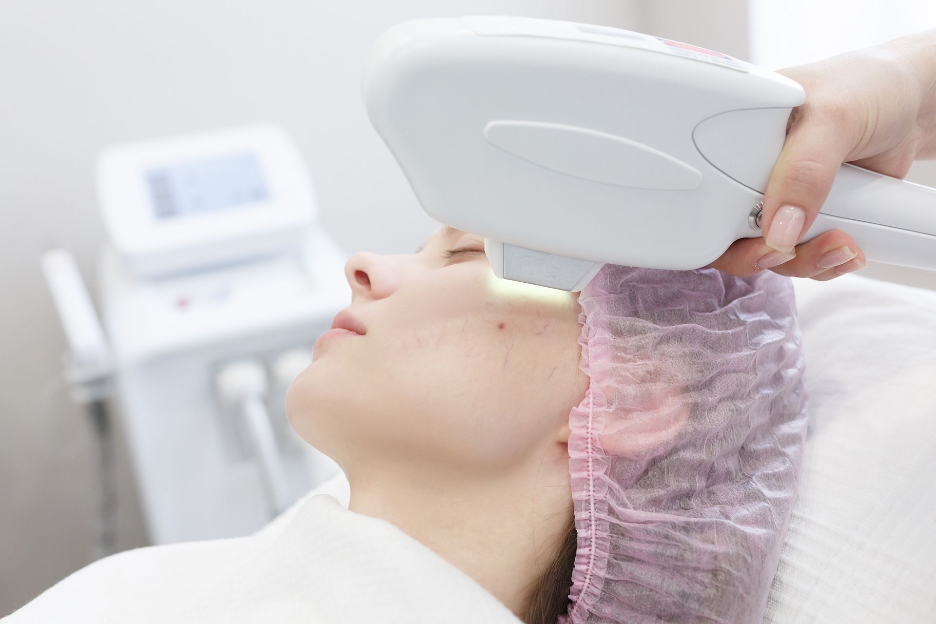 Une femme reçoit un traitement d'épilation au laser sur son visage.