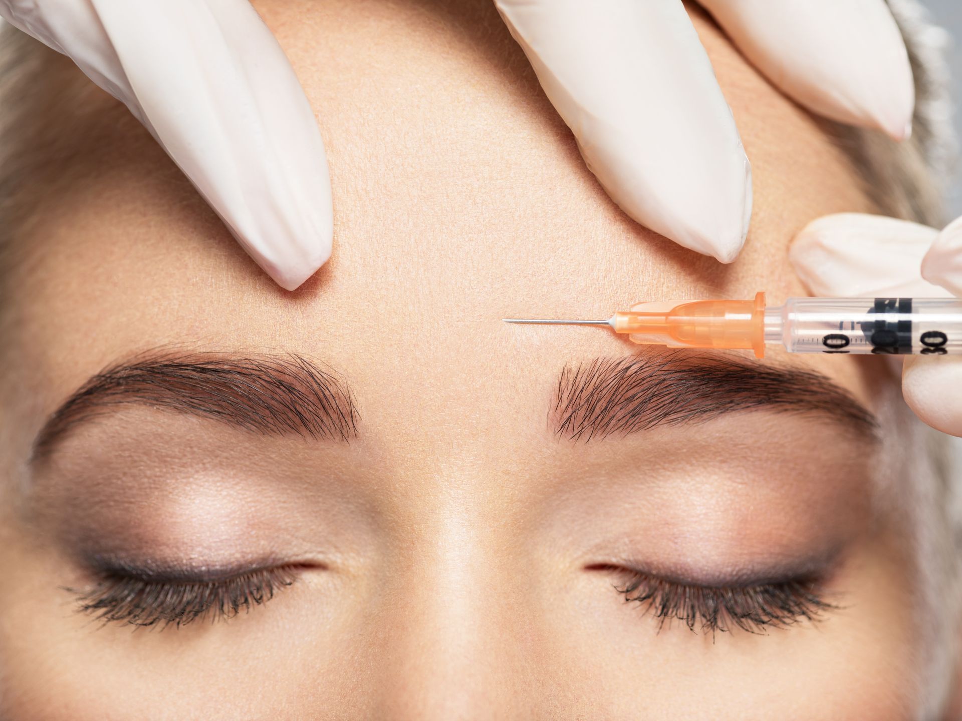 Une femme reçoit une injection de botox dans le front.