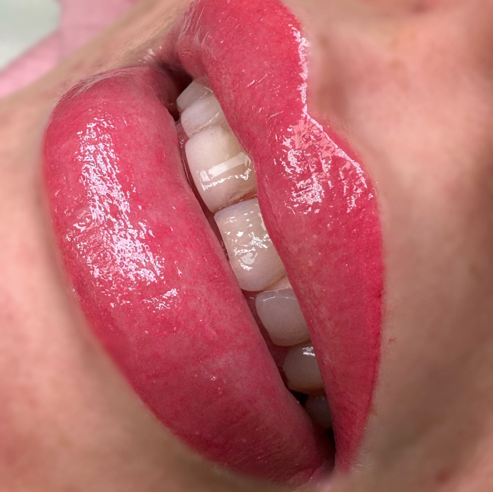 Labios rosados ​​brillantes ligeramente entreabiertos, dejando ver los dientes blancos.