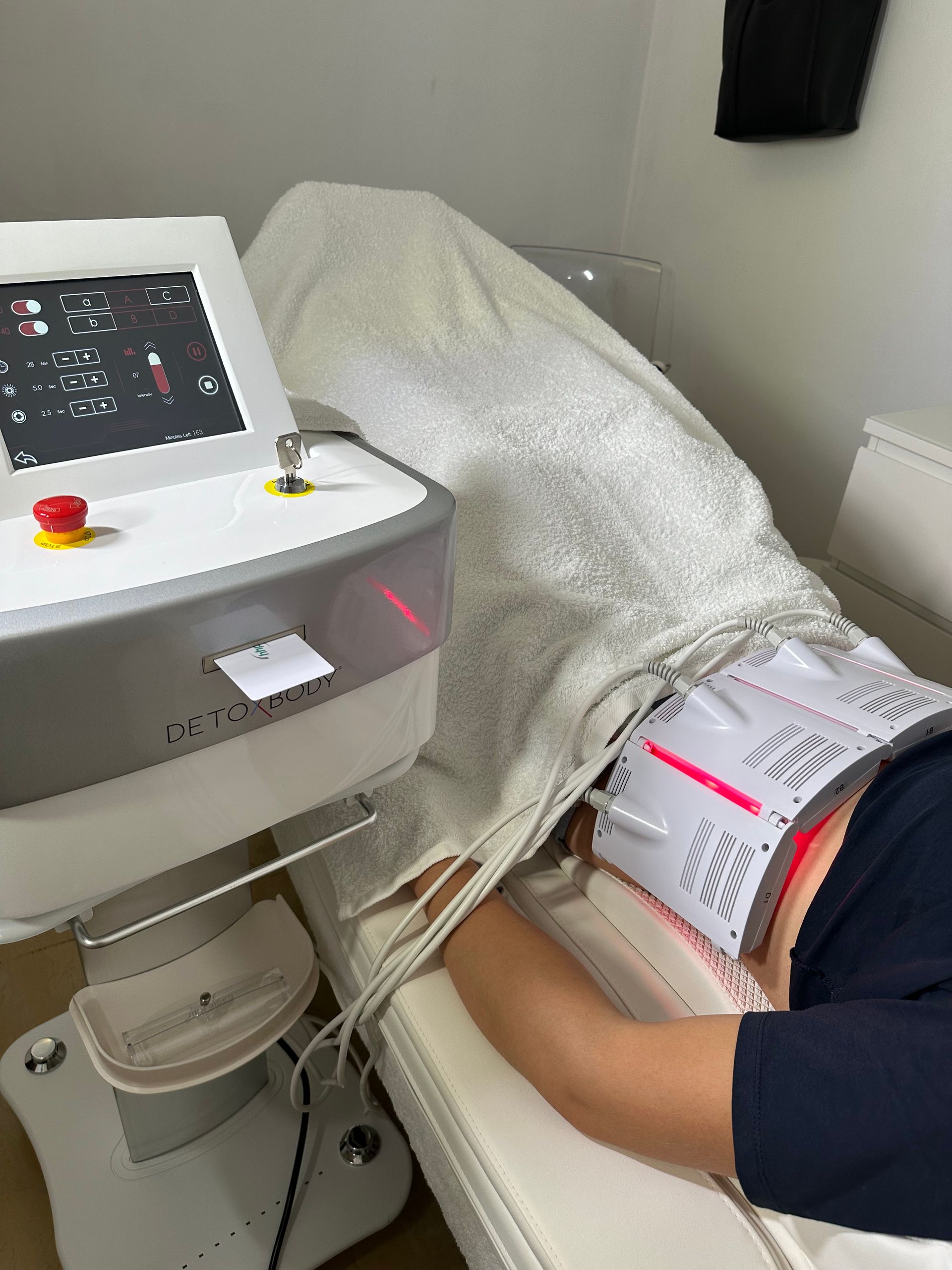 Tratamiento de de Lipoláser