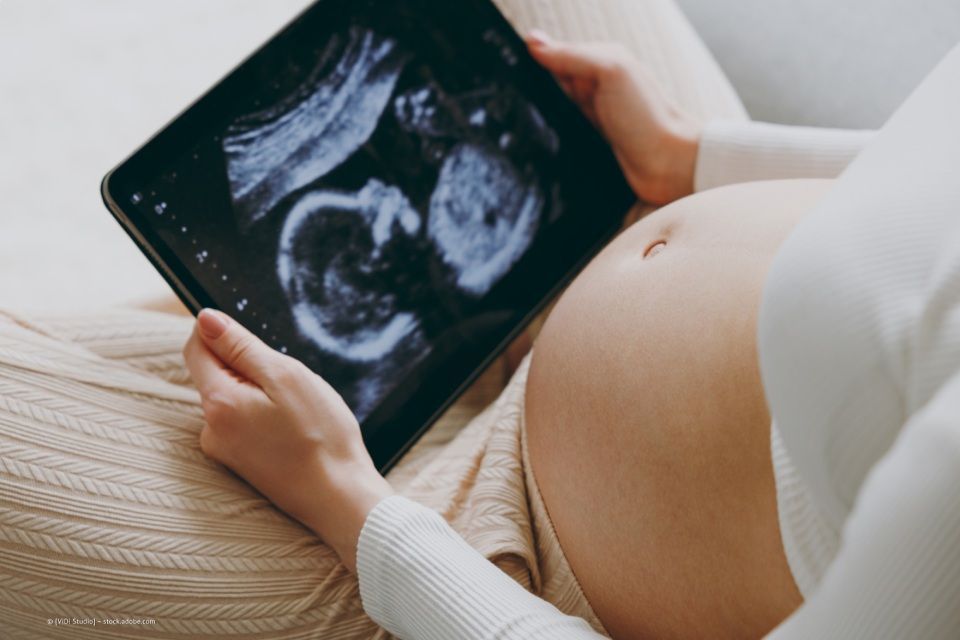 Schwangere hält Ultraschallbild in den Händen