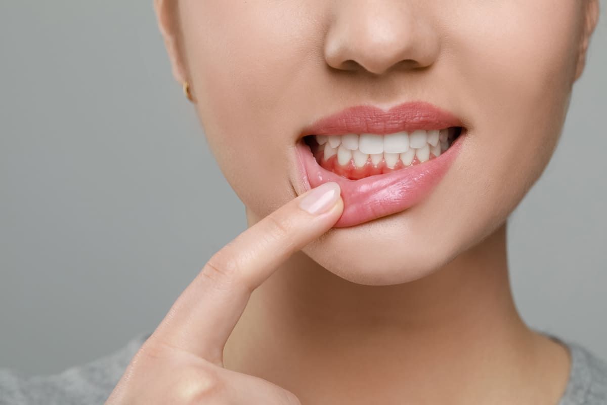 Eine Frau zeigt mit ihrem Finger auf ihre Zähne | Zahnärzte am Westkreuz