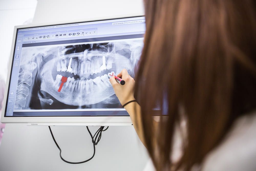 Eine Frau zeichnet auf ein X-ray eines Zahns | Zahnärzte am Westkreuz