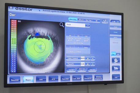 Un monitor de computadora muestra una imagen del ojo de una persona.