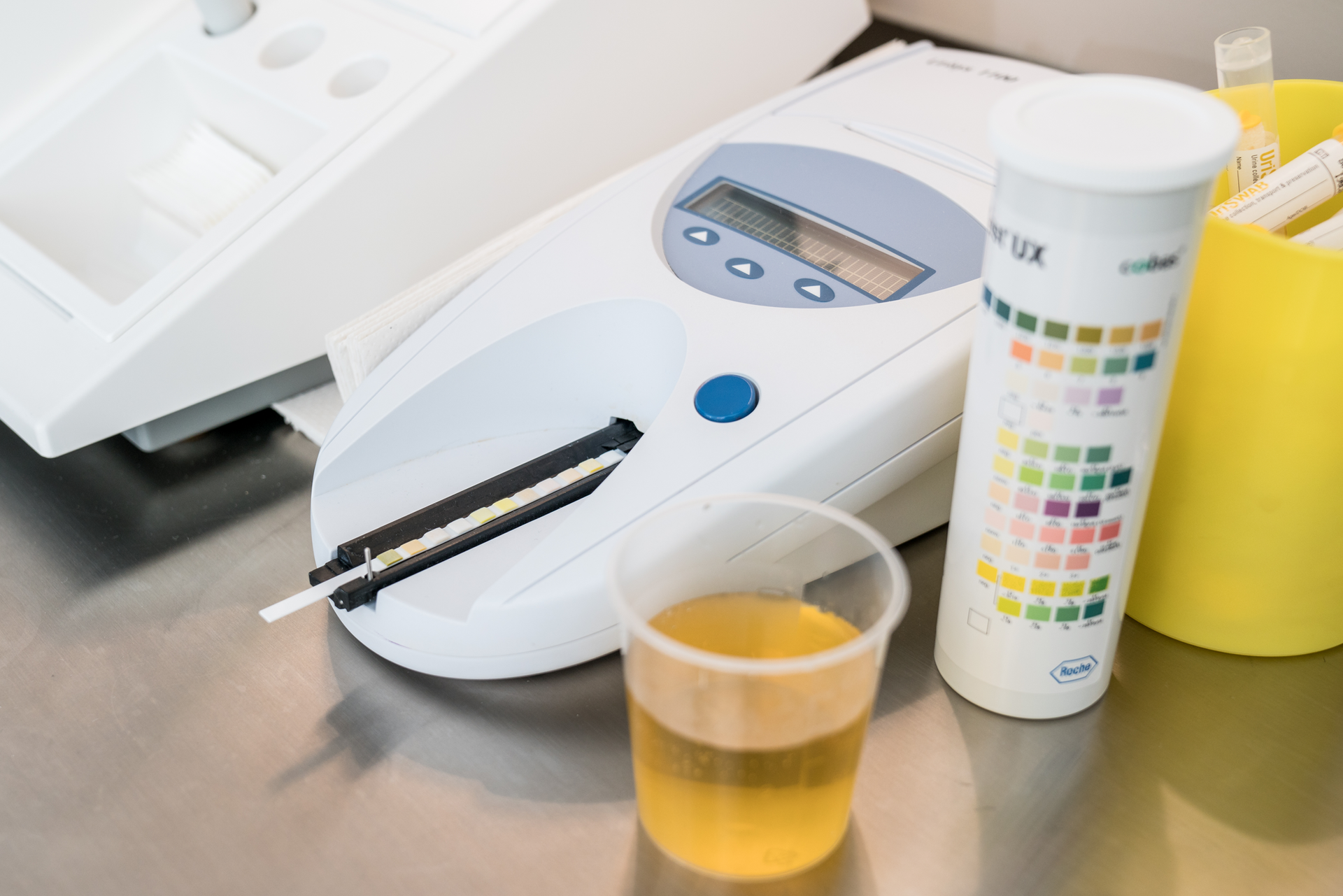 Auf einem Tisch neben einer Maschine steht ein Becher mit Urin.