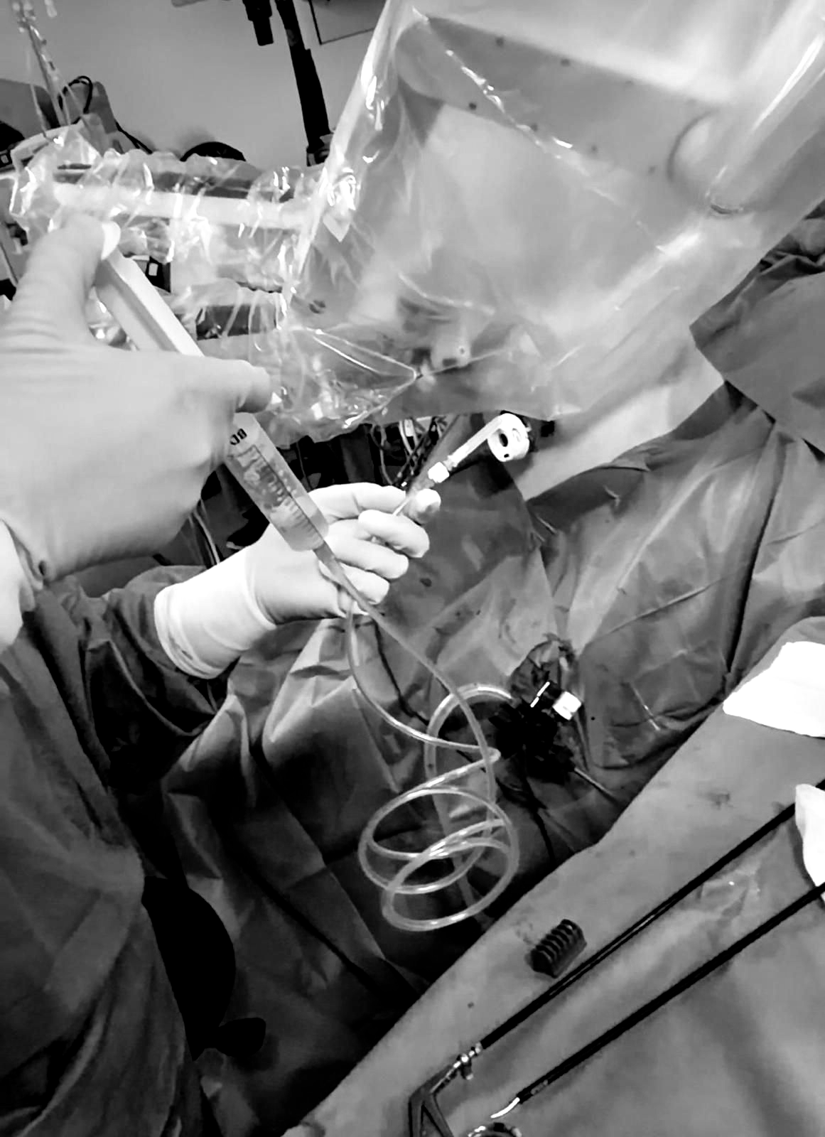 Personal médico utiliza un dispositivo con cámara durante una intervención quirúrgica, bajo paños estériles azules.
