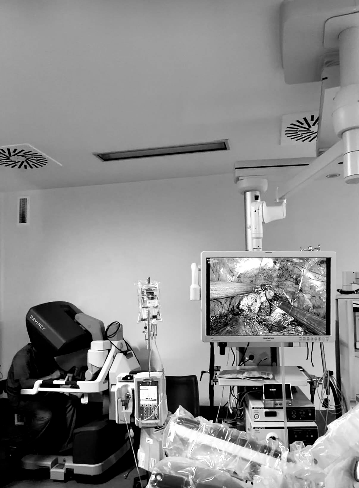 Quirófano con un médico en una consola robótica y una pantalla que muestra un procedimiento interno.