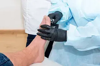 Un profesional médico con guantes examina el pie de un paciente.