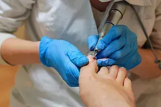 Una persona con guantes azules utiliza un taladro de uñas en la uña del pie de una persona, probablemente en un entorno médico o de salón.