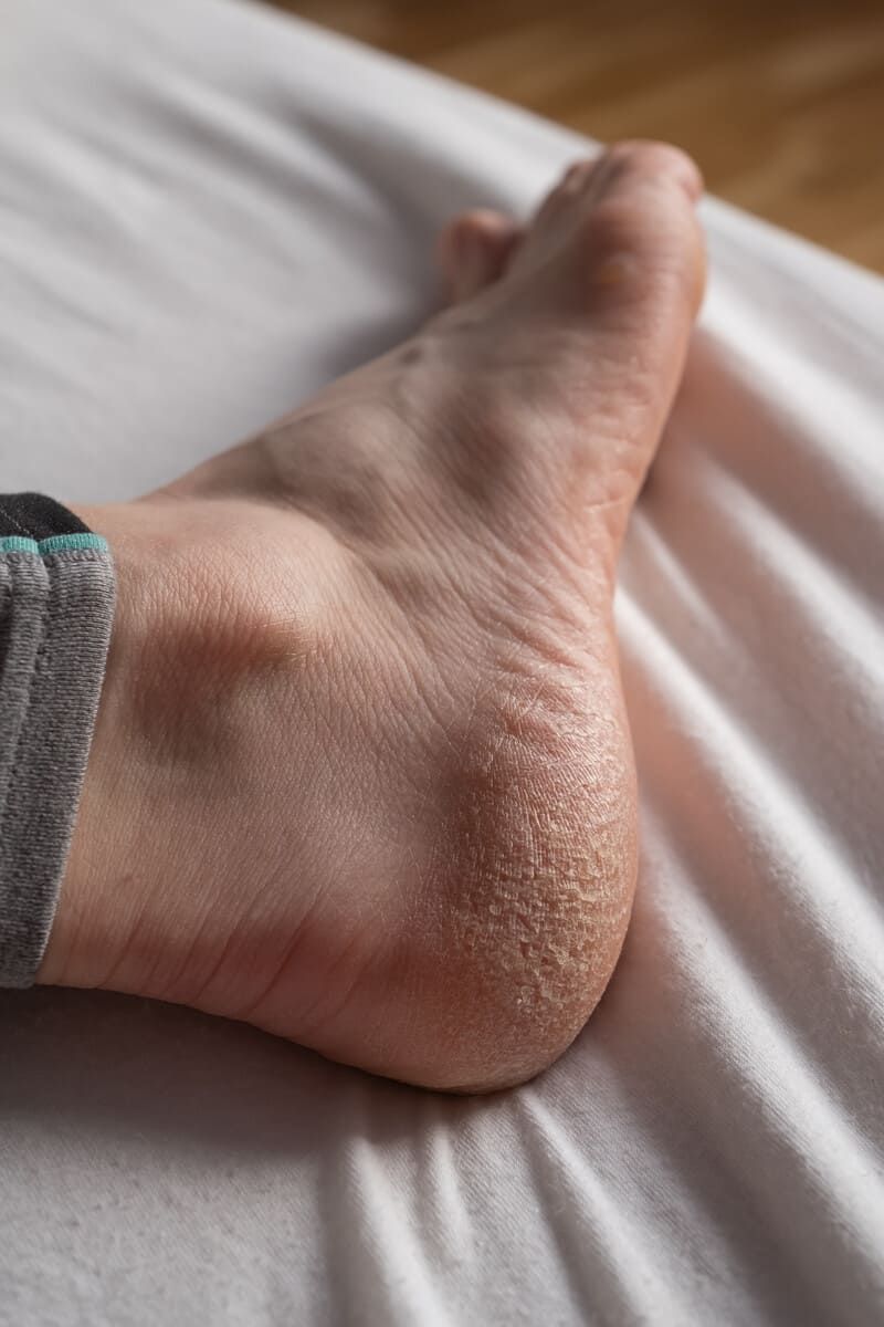 Una persona se está haciendo examinar el pie por un médico.