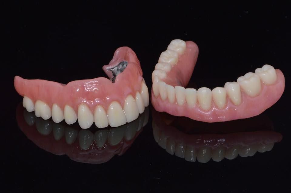 Dos juegos de dentaduras postizas con bases rosas y dientes blancos, sobre un fondo negro reflectante.