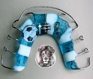 Zahnspange mit Fußball-Design