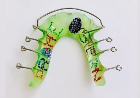 Grüne Zahnspange mit Schriftzug