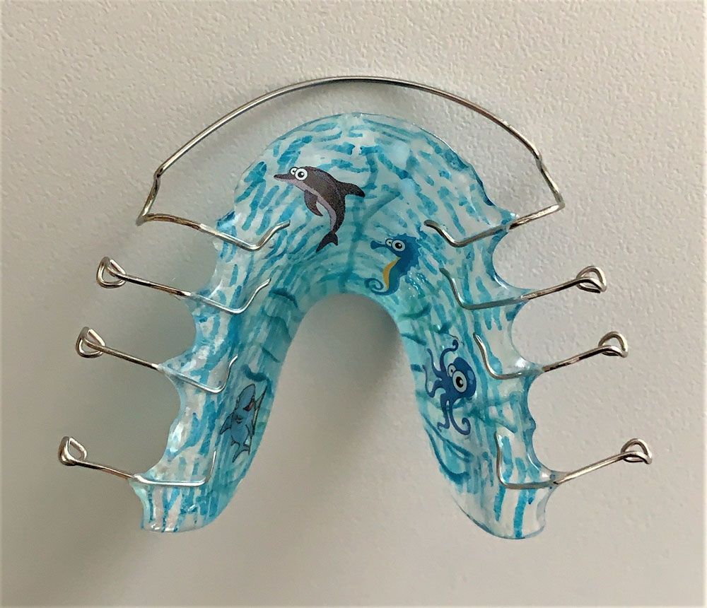 türkisfarbene Zahnspange mit Meerestieren