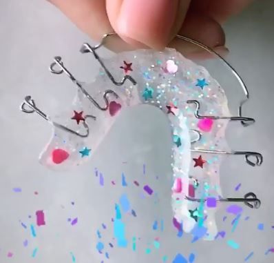 Transparente Zahnspange mit farblichen Akzenten