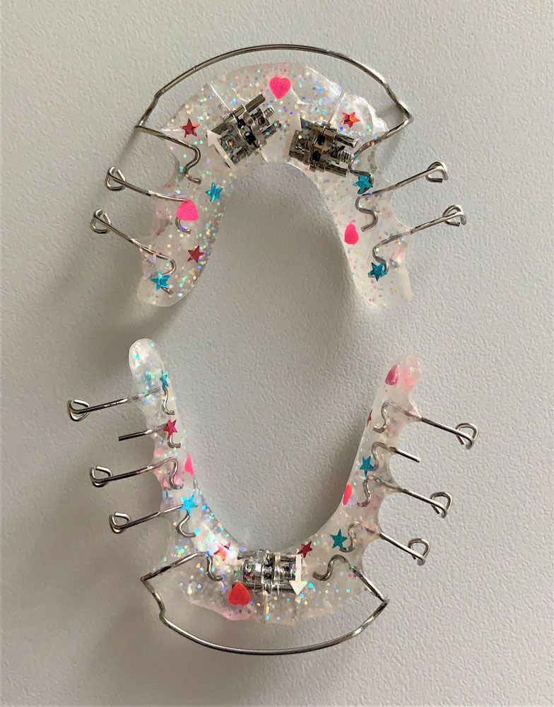 transparente Zahnspange mit buntem Muster