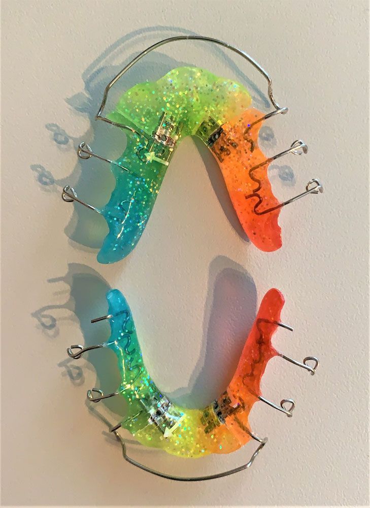 mehrfarbige Zahnspange