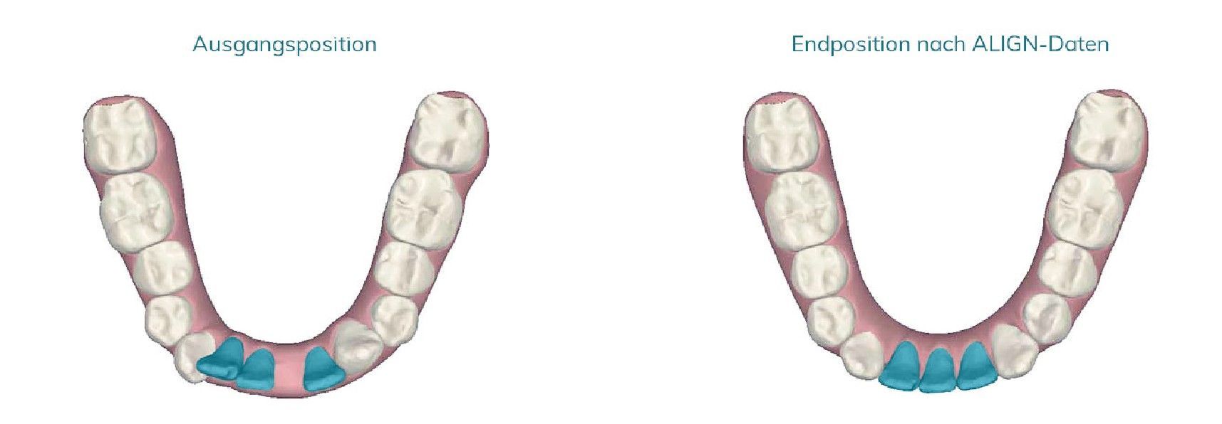 Kieferorthopäde Neumarkt