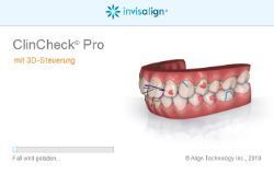 Logo Invisalign ClinCheck Pro