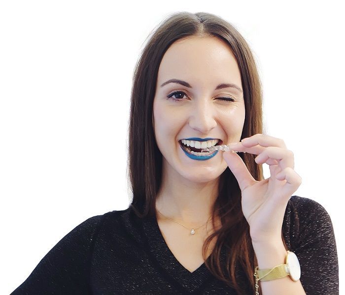 Frau mit fast unsichtbarer Zahnspange