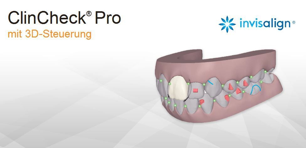 Modell ClinChecl Pro von invisalign