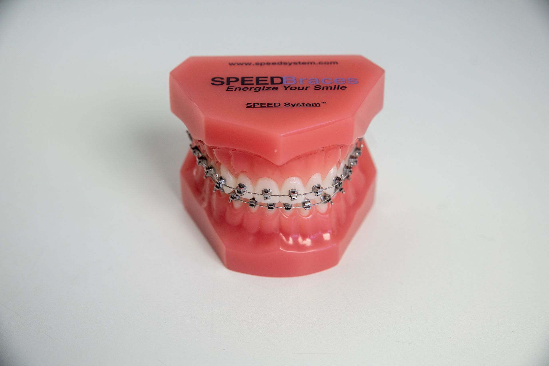 Gebissmodell mit fester Zahnspange