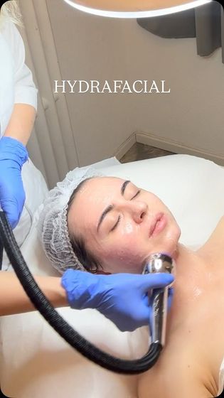 Una donna riceve un trattamento HydraFacial. Un'operatrice con guanti blu le appoggia un dispositivo sul viso,