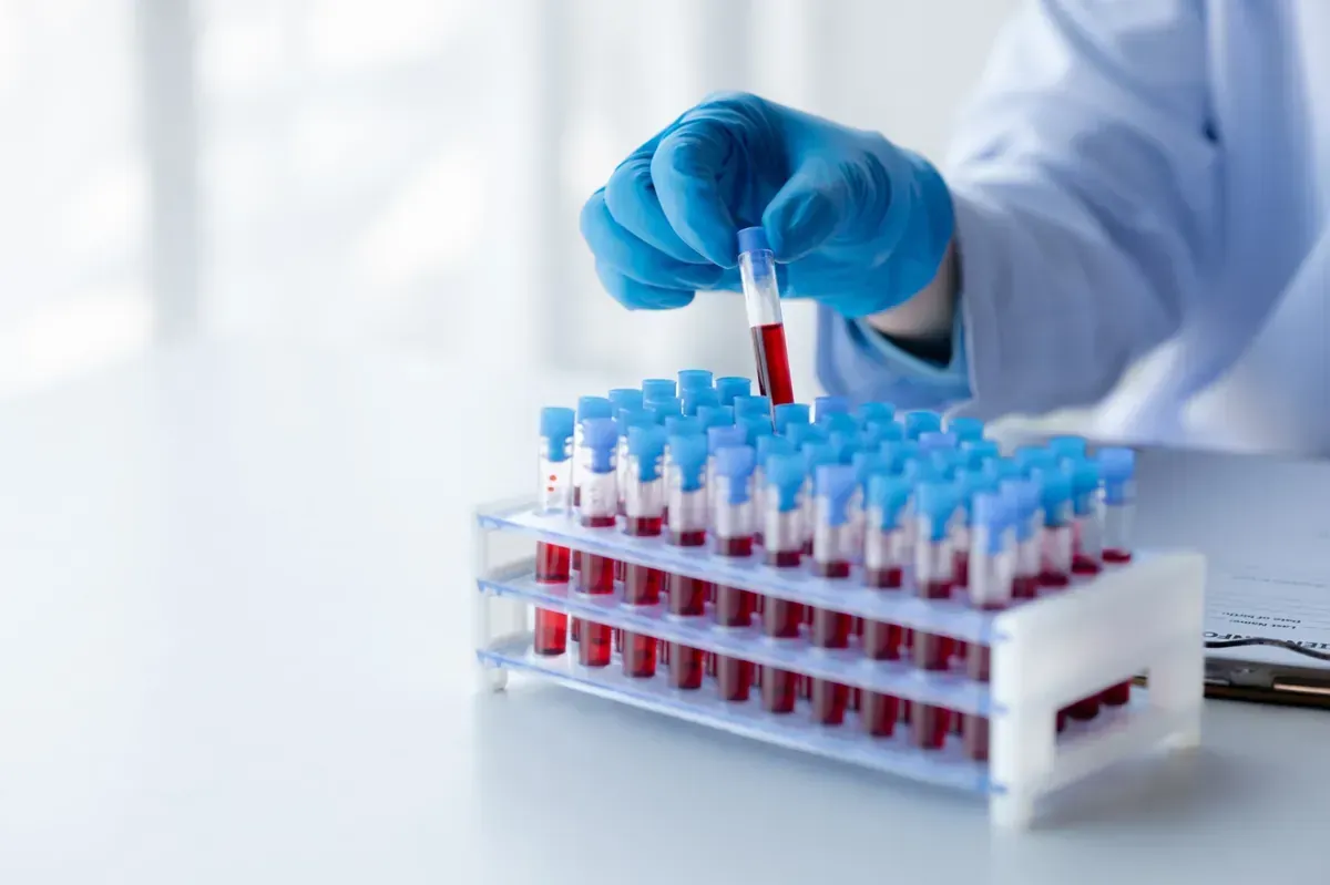 Mano enguantada que sostiene un tubo de muestra de sangre encima de un estante de muestras de sangre.