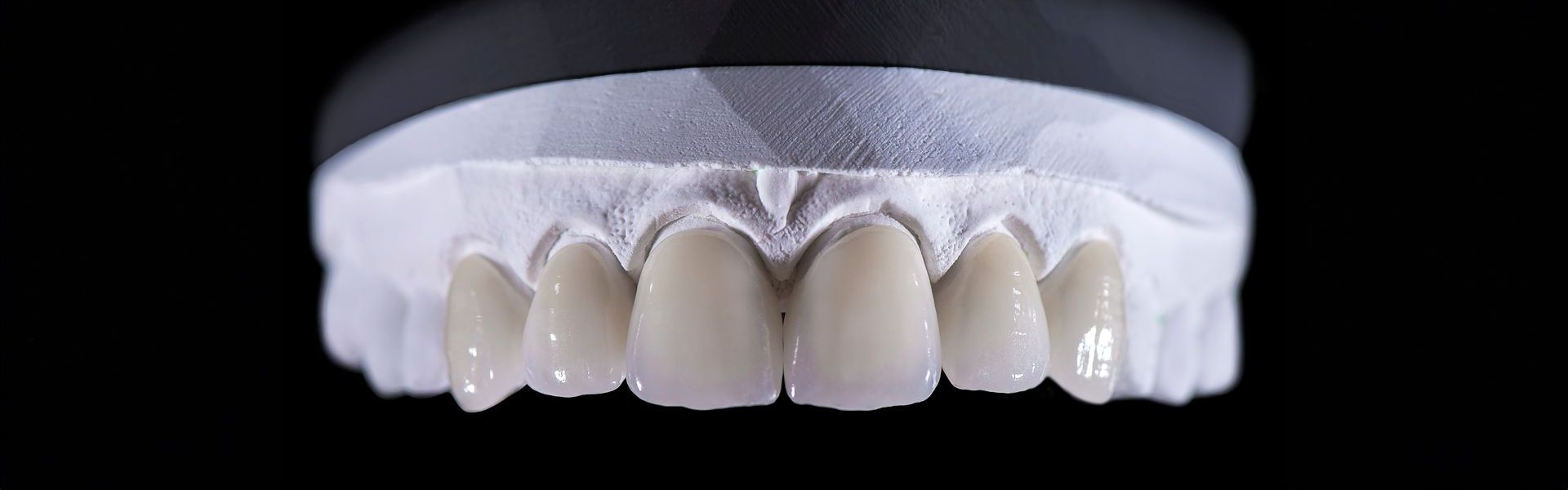 Eine Nahaufnahme eines Modells der Zähne einer Person auf schwarzem Hintergrund | Zahnmedizin am Neckar
