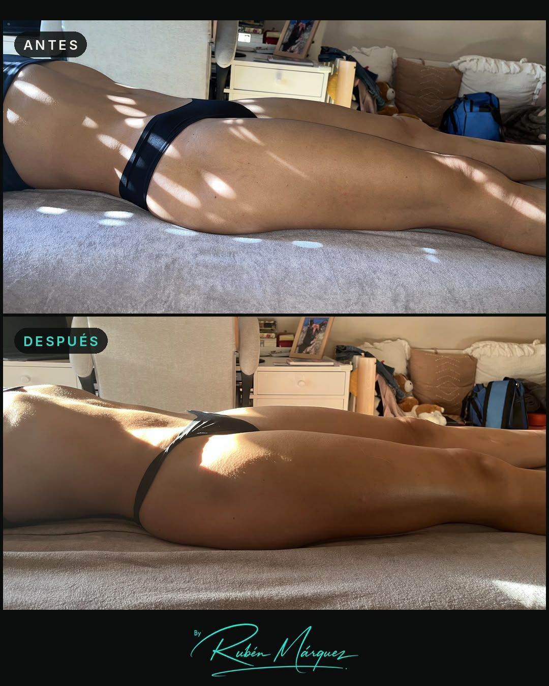 Dos fotos de playa una al lado de la otra de una persona en traje de baño negro tumbada boca abajo en el interior, junto a una ventana.