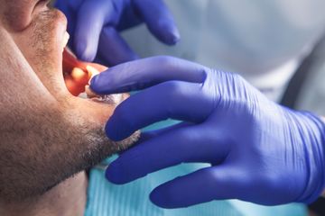Un dentiste portant des gants bleus examine la bouche ouverte d'un patient à l'aide d'instruments dentaires.