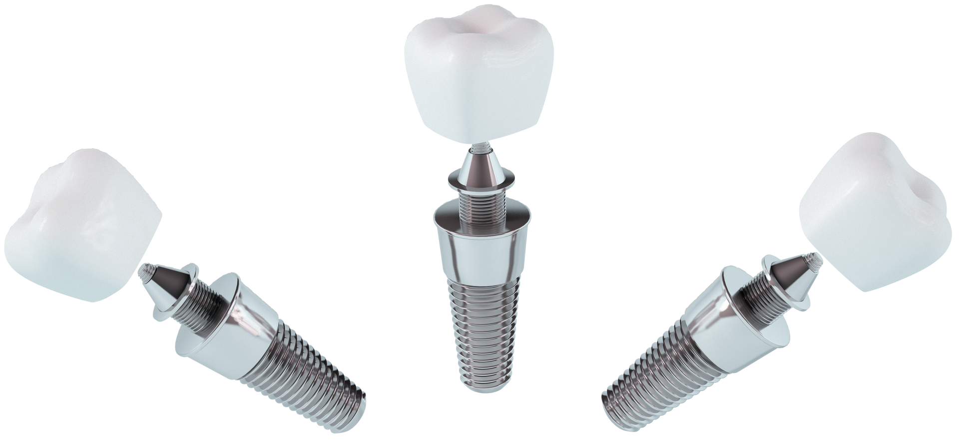 Trois implants dentaires avec couronnes blanches sur fond blanc
