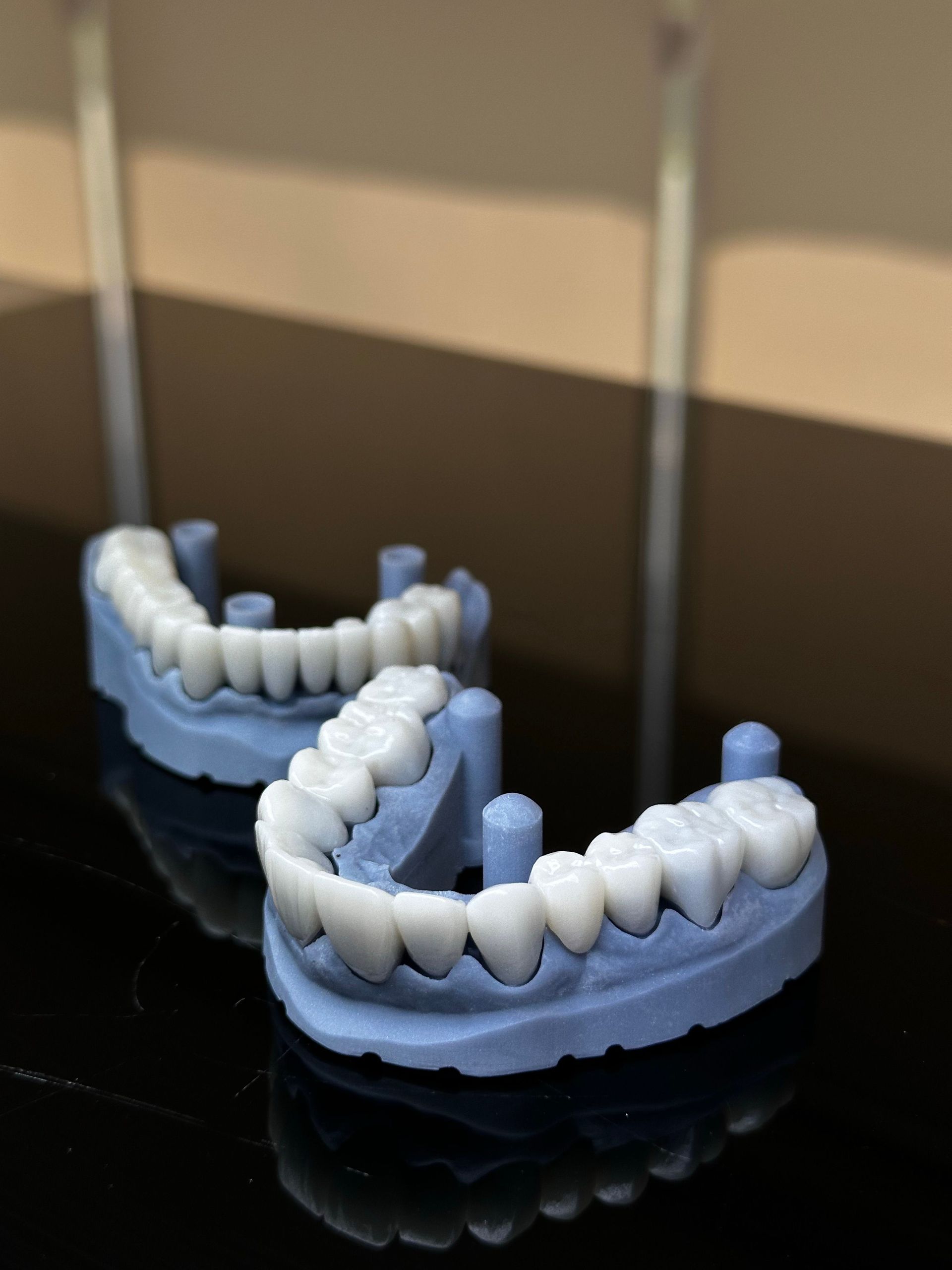 Moules dentaires imprimés en 3D avec des dents blanches sur une surface noire