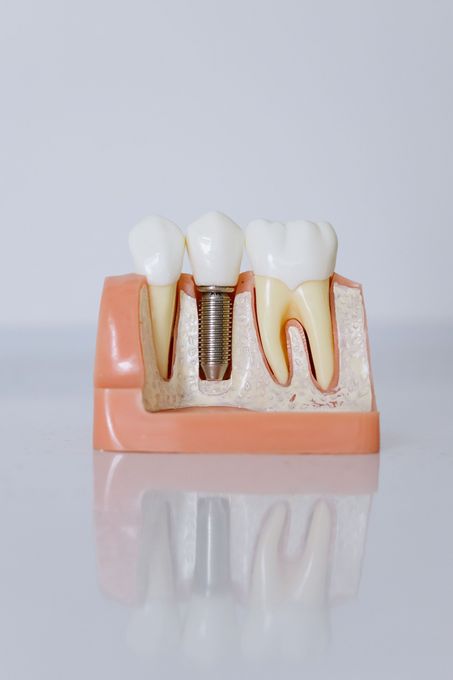 Enfant souriant, les dents écartées, vêtu d'un haut rose, regardant l'objectif.