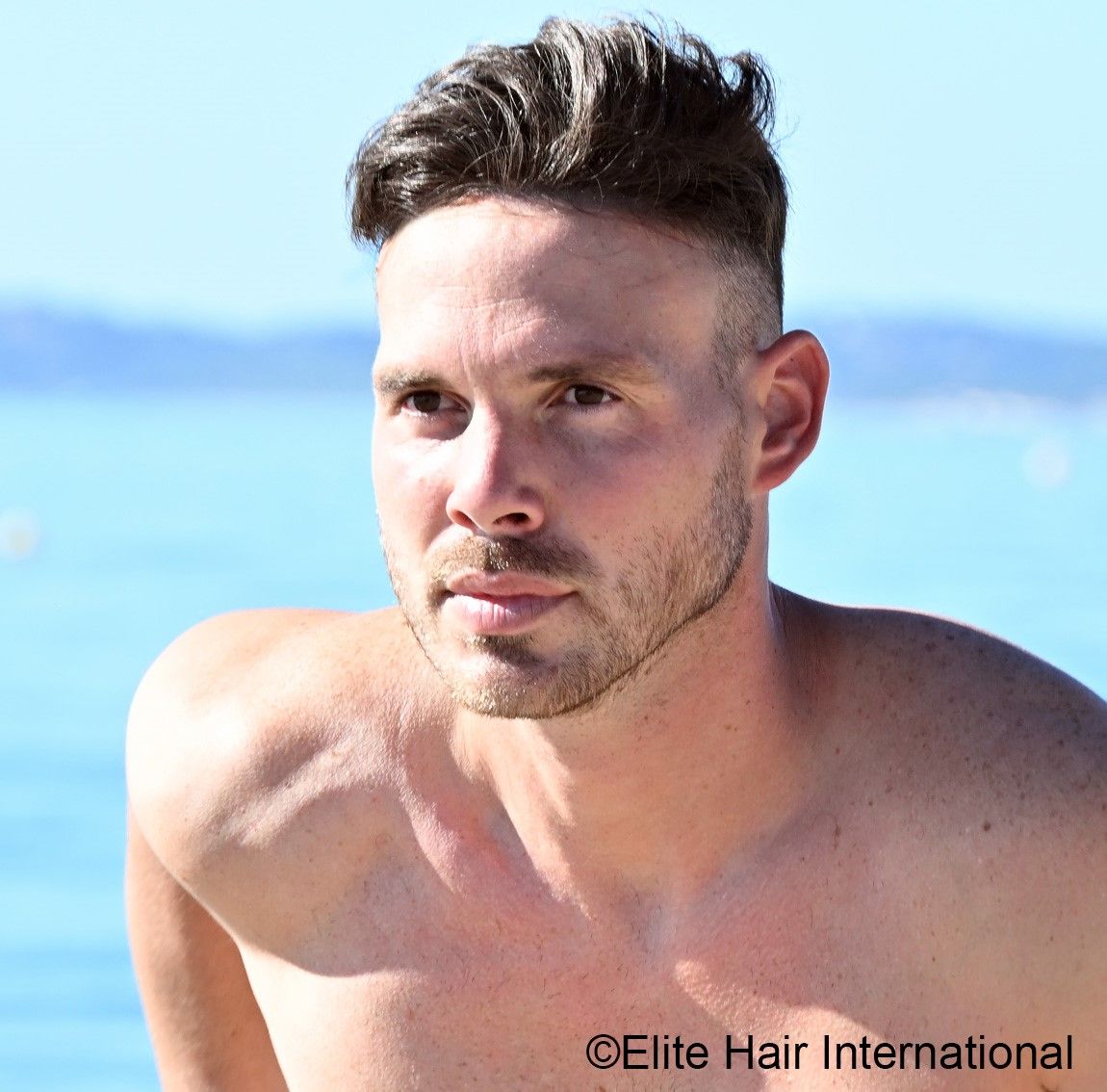 Prothèse capillaire Dermofusion