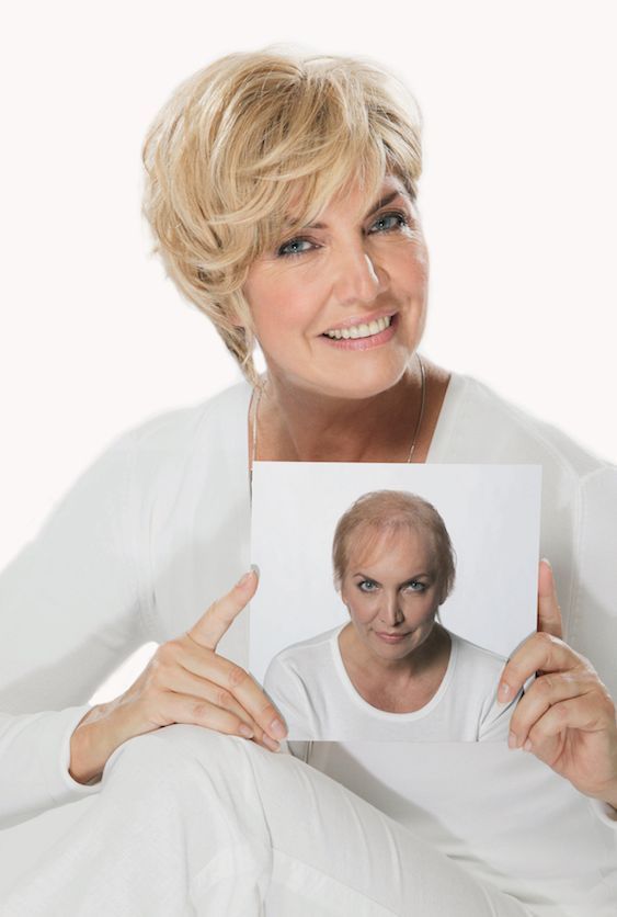 Hairdreams Echhaarverdichtung