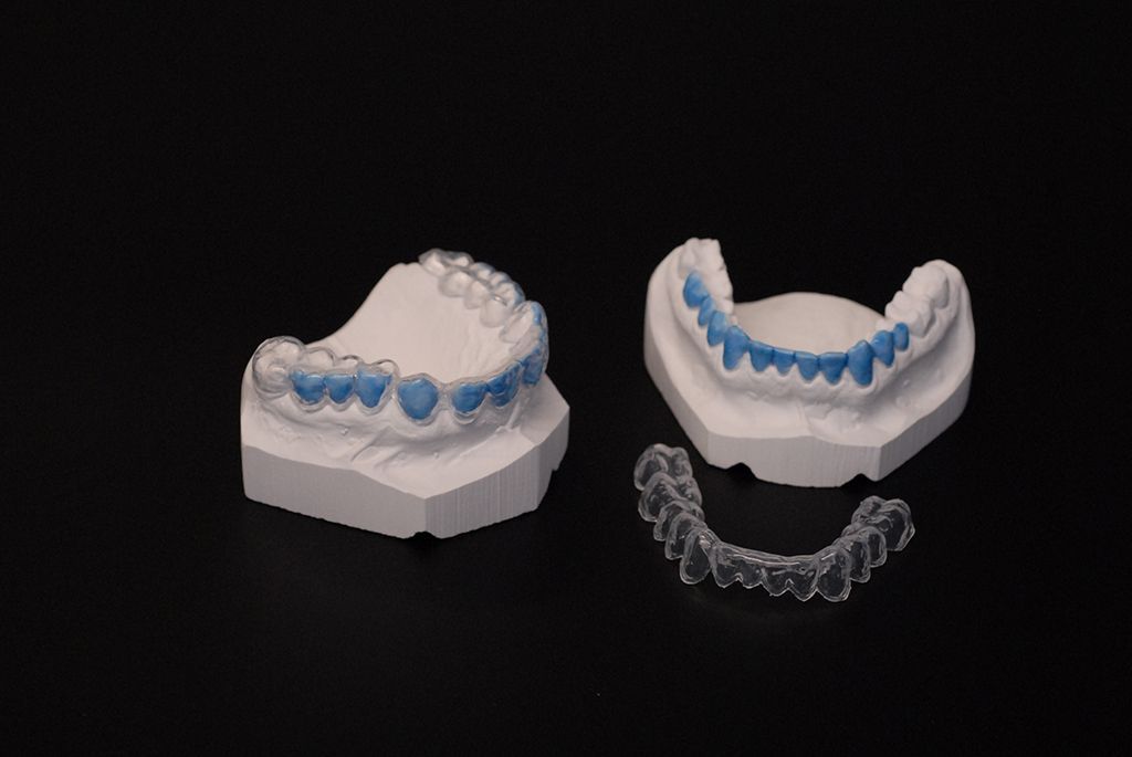 Bleachingschienen - Hauser Zahntechnik GmbH - Gunzgen