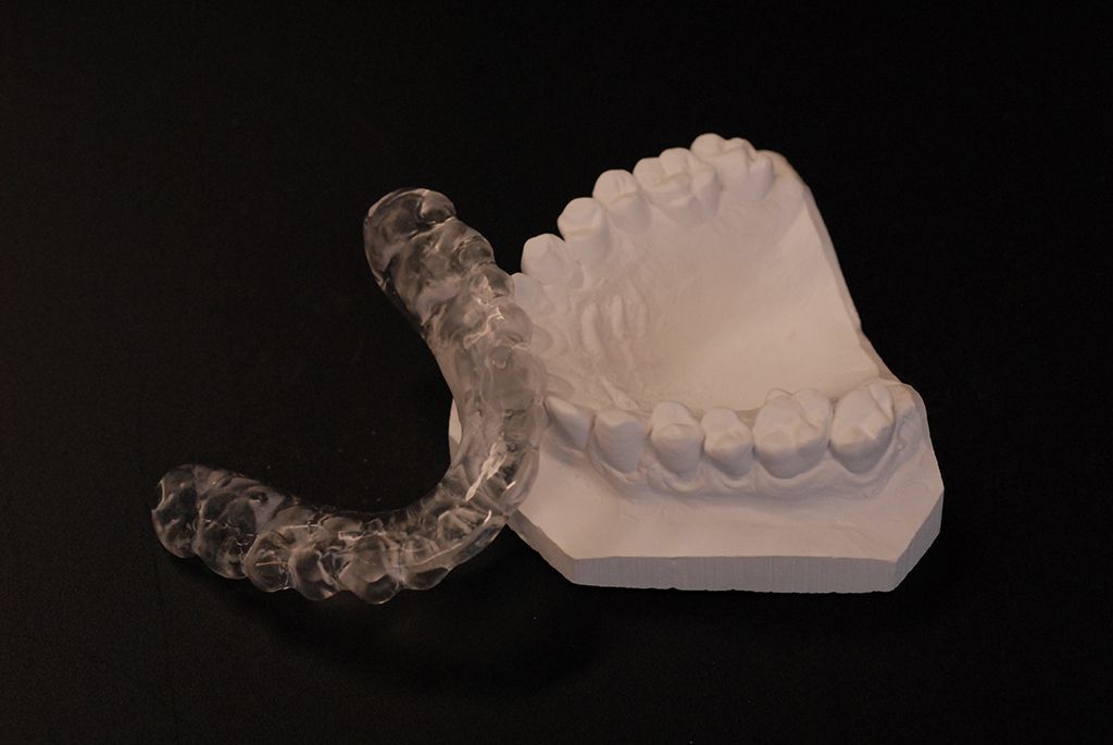 Michiganschiene - Hauser Zahntechnik GmbH - Gunzgen