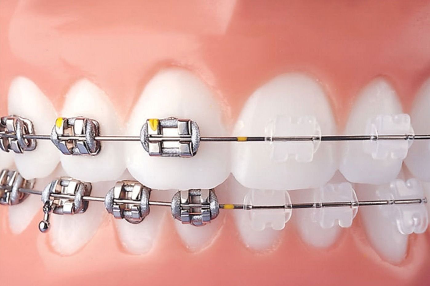 Uno studio dentistico con una poltrona viola, opere d'arte e orchidee bianche.