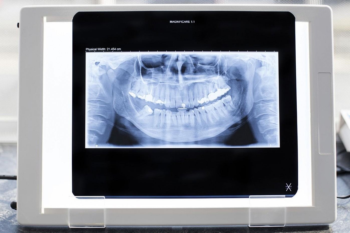 Donna che esegue una radiografia dentale. È in piedi di fronte a un apparecchio per immagini panoramiche.