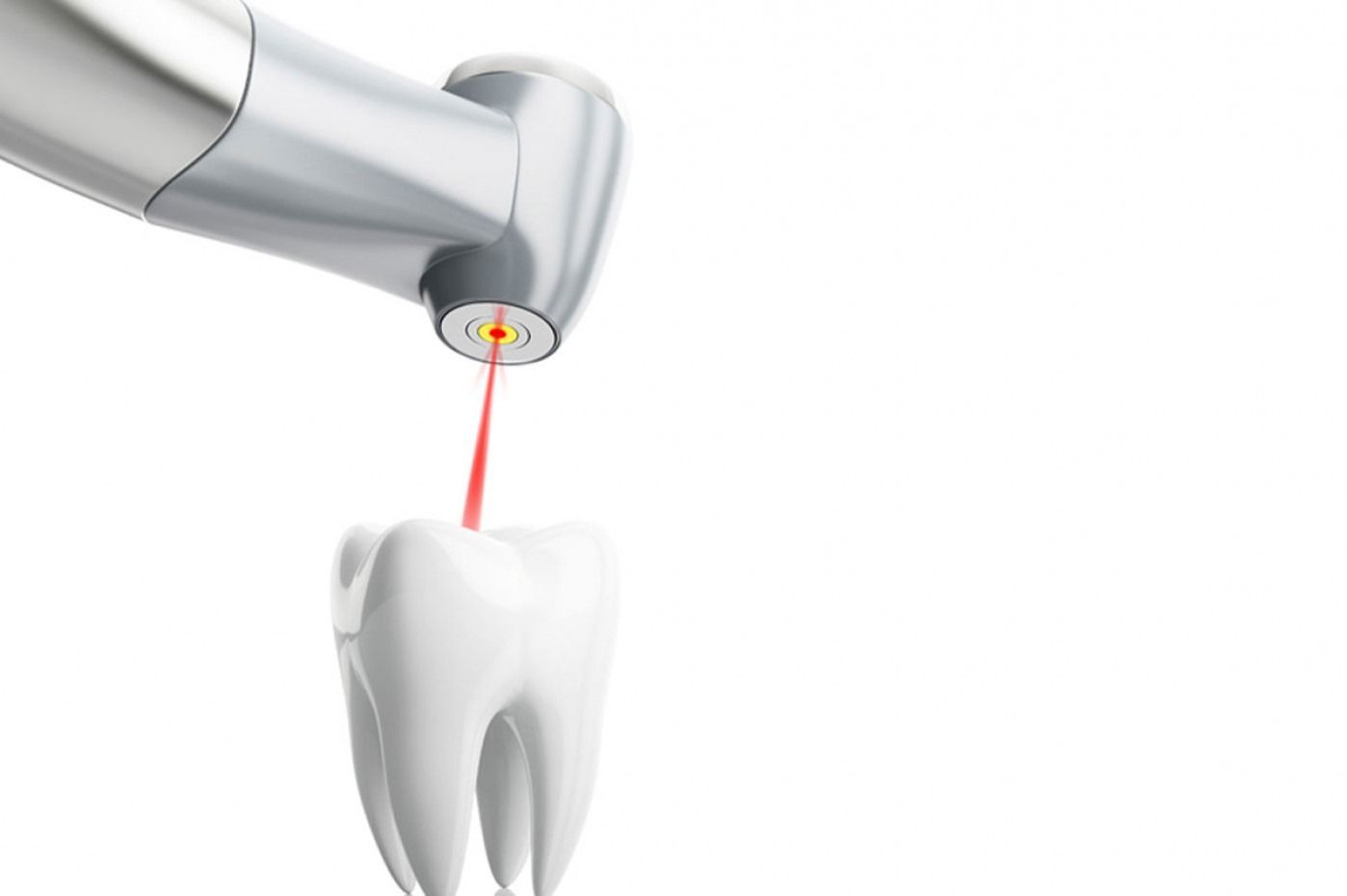 Pulizia dentale: la bocca del paziente viene aperta e pulita con le mani guantate e gli strumenti dentali.