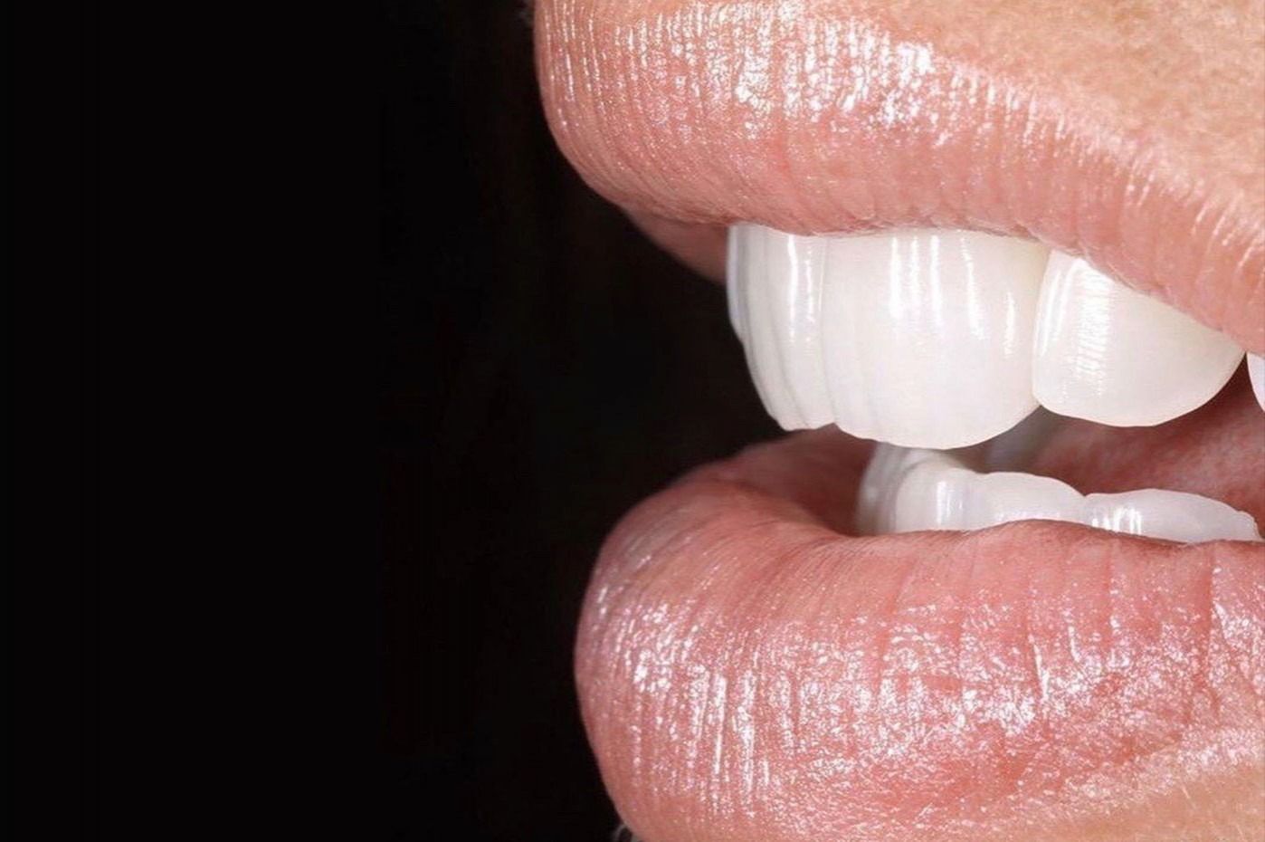 Dentista che lucida i denti di un paziente con uno strumento rotante; primo piano della bocca e della mano guantata.