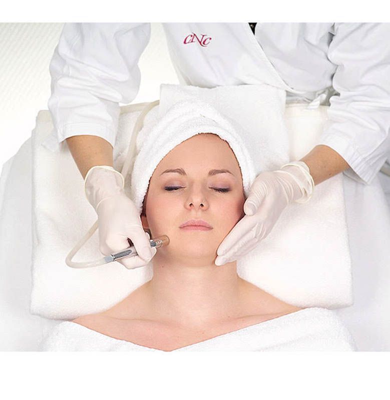 Diamant Mikrodermabrasion - Behandlung