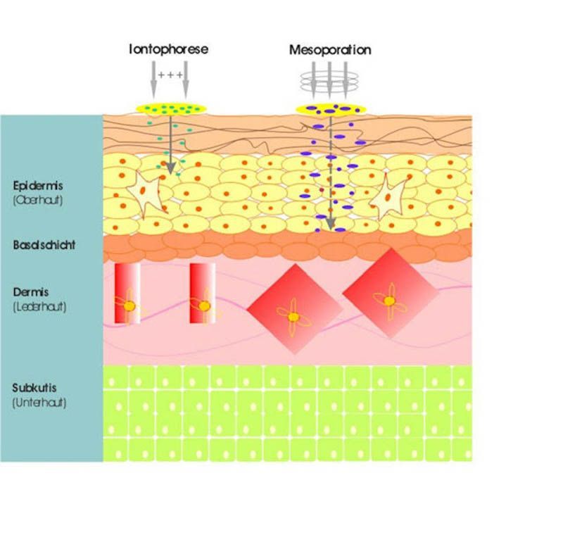 Mesoporation - Grafik Methode