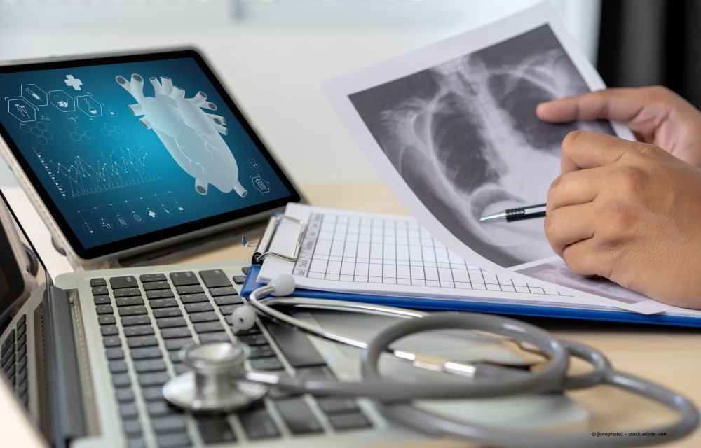 Der Arzt begutachtet ein Röntgenbild des Brustkorbs neben einem Laptop, auf dem die Krankenakte und das Stethoskop auf dem Schreibtisch liegen.